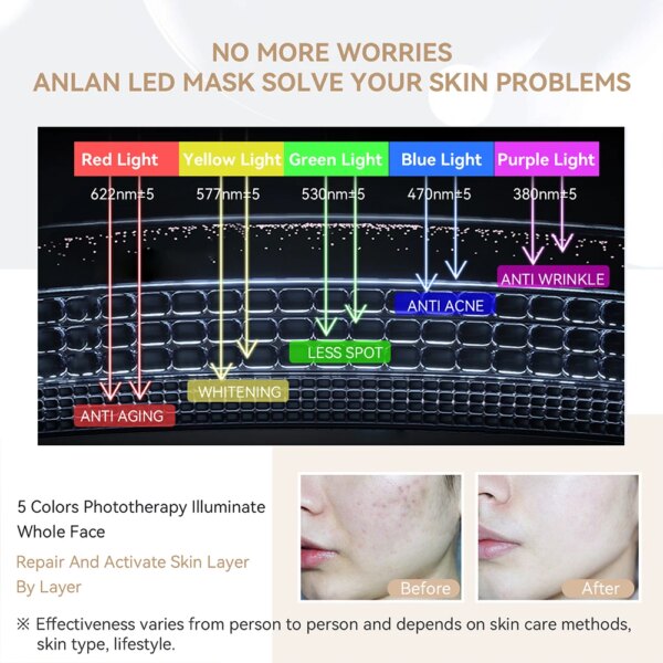 ANLAN LED Maske – 5 Farger Lysterapi, Anti-Aging & Hudfornyelse