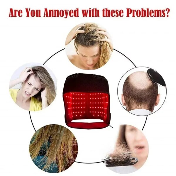 180-piece red light hair regrowth cap with near-infrared therapy
